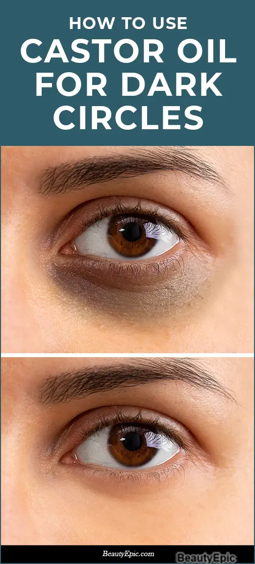 How To Use Castor Oil For Dark Circles 