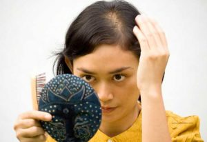 alopecia hair loss