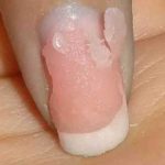How to Remove Acrylic Nails With Acetone