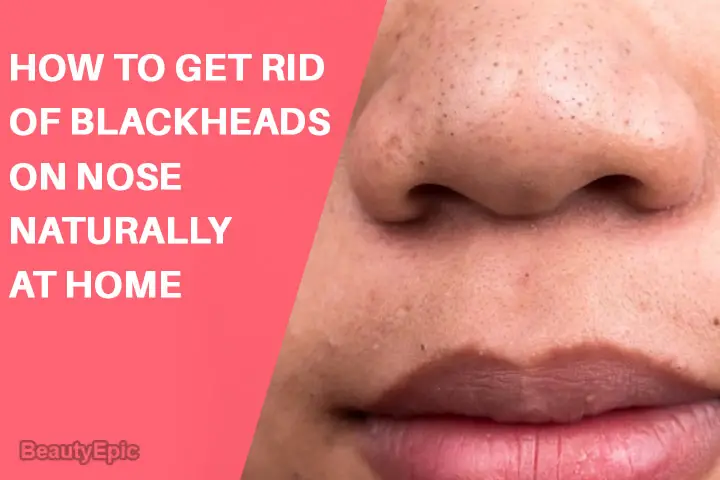 how to get rid of blackheads on nose