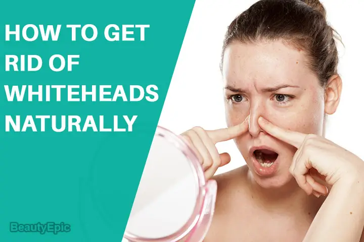 how to get rid of whiteheads