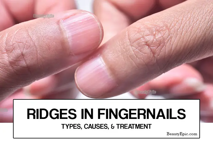 Ridges in fingernails