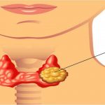 Thyroid Naturally