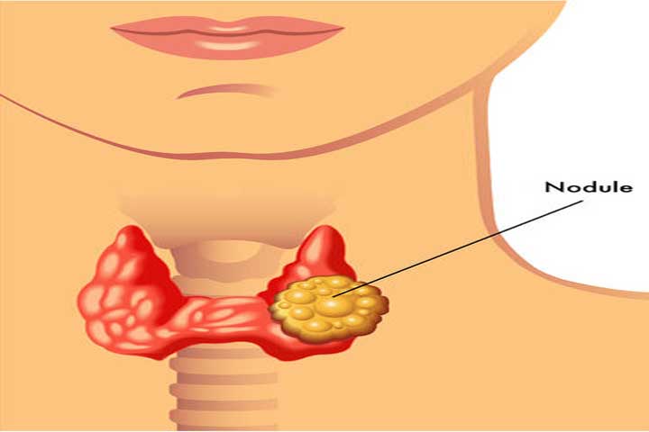 Thyroid Naturally