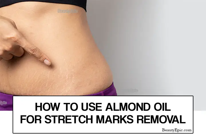 almond oil for stretch mark prevention