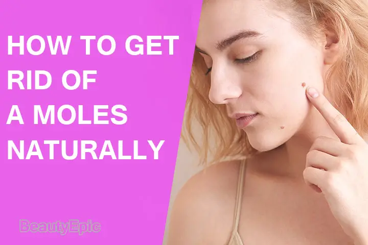 how to get rid of moles