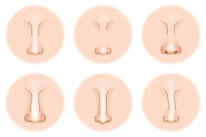 nose shape