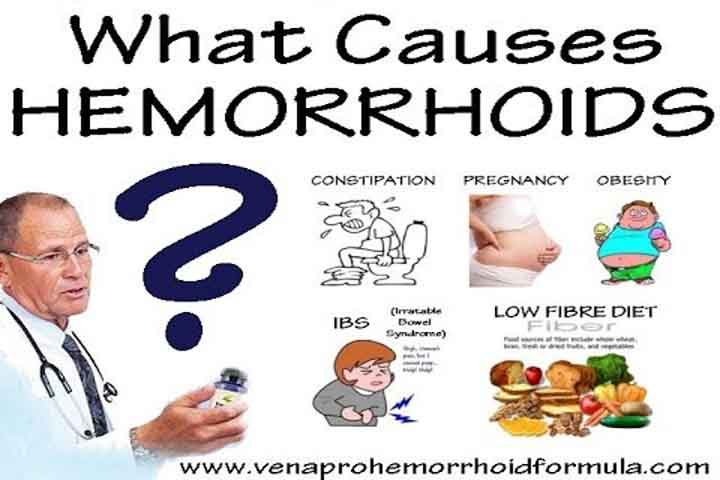 what causes hemorrhoids