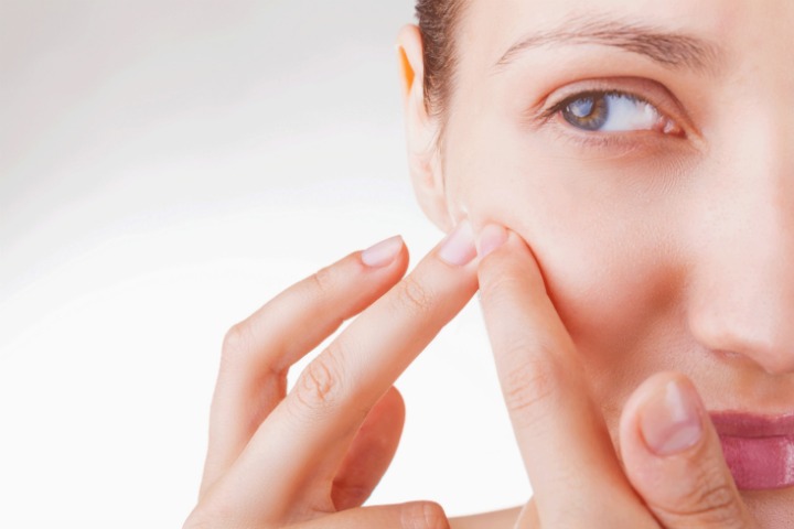Get Rid Of Pimples Overnight Fast