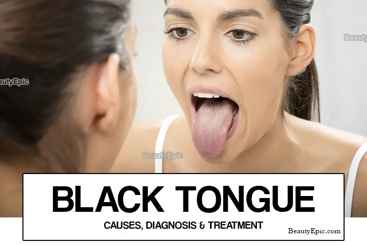 black tongue