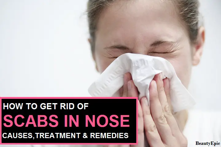 how to get rid of scabs in nose