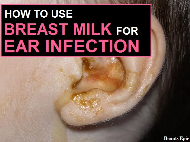 breast milk for ear infection