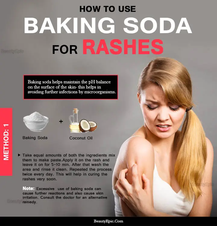 baking soda for rashes