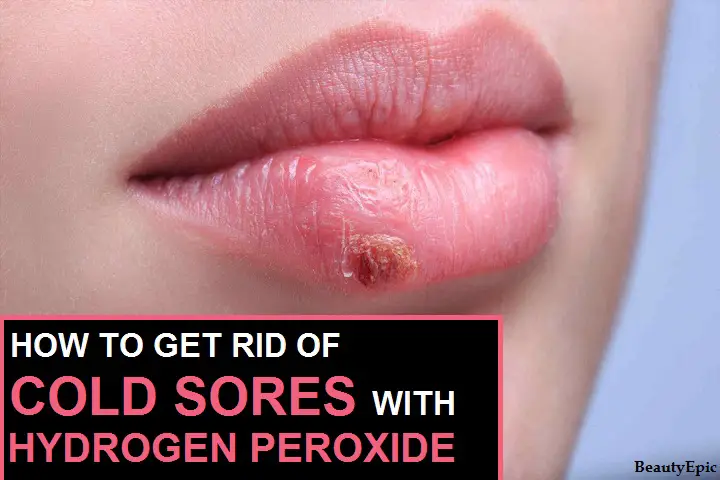 hydrogen peroxide for cold sores