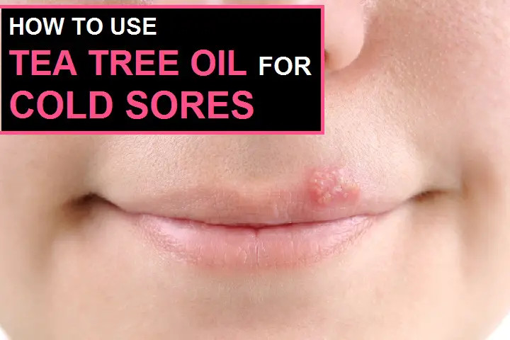 tea tree oil for cold sores