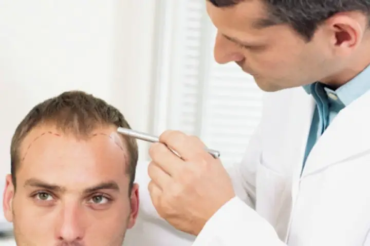 Hair Transplant Specialists in Hyderabad
