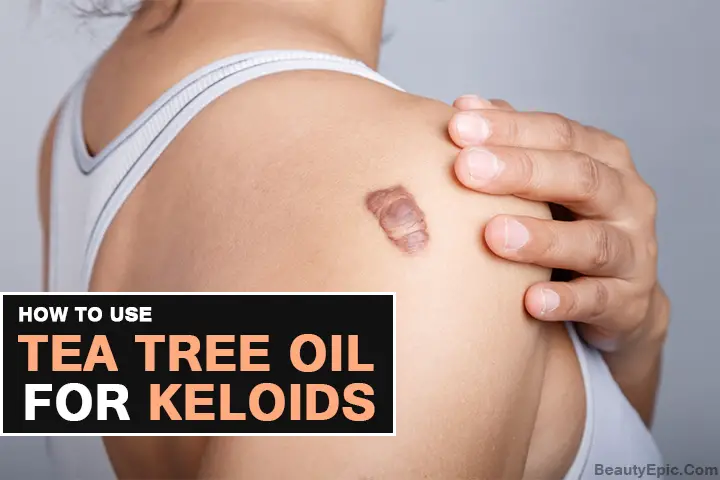 How to Use Tea Tree Oil for Keloids