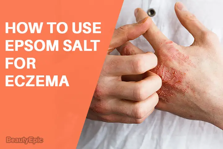 epsom salt for eczema