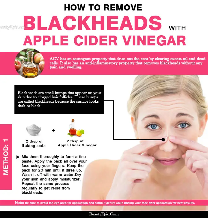 apple cider vinegar and baking soda for blackheads