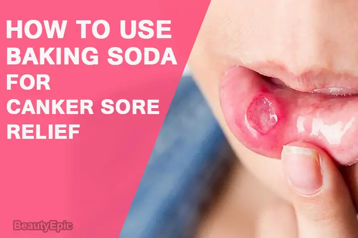 baking soda for canker sore