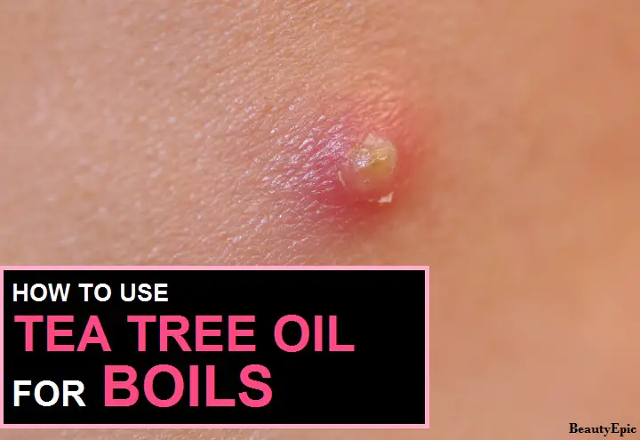 tea tree oil for boils