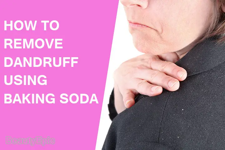 baking soda for dandruff