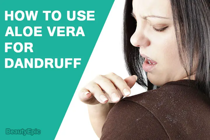 how to use aloe vera for dandruff