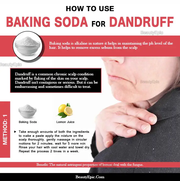 baking soda for dandruff