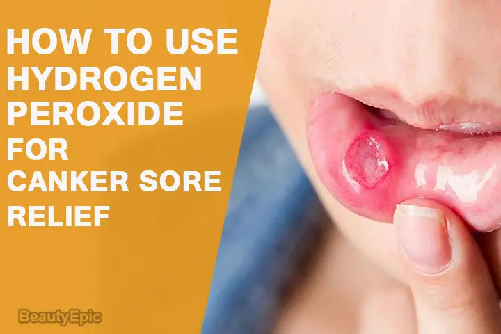 hydrogen peroxide for canker sores