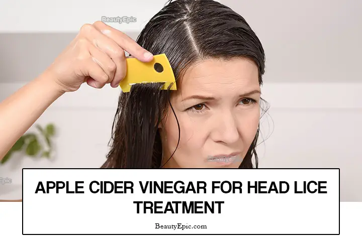 apple cider vinegar for head lice treatment