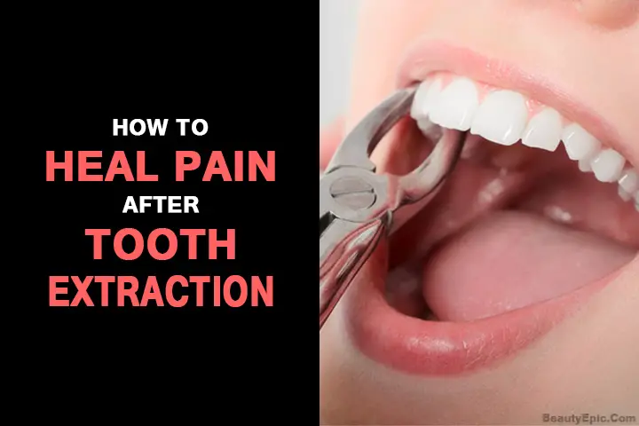 How to Heal Pain After Tooth Extraction