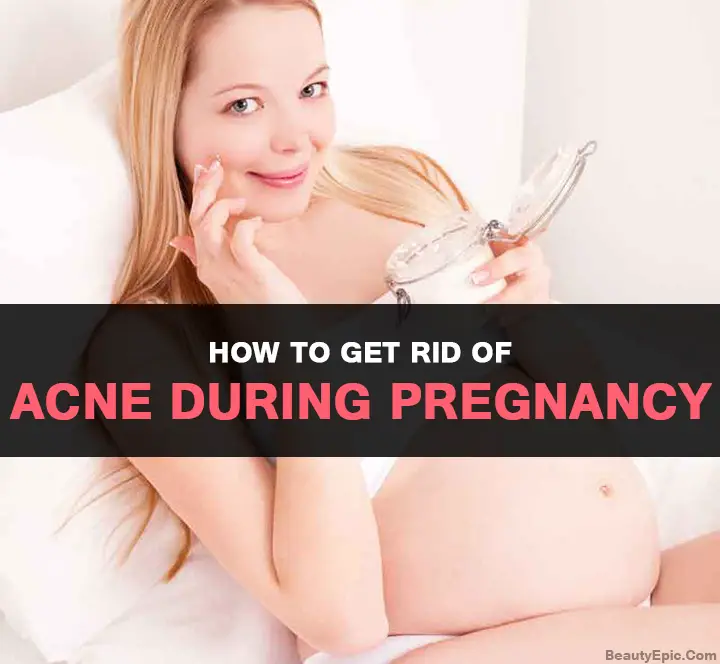 acne during pregnancy