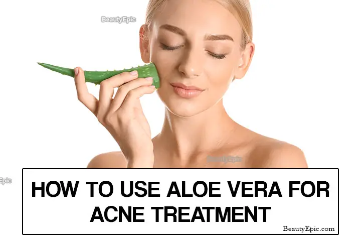 aloe vera for acne