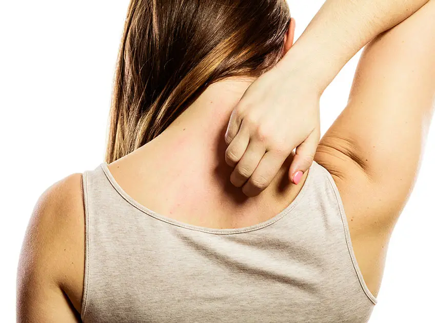 can apple cider vinegar cure shingles