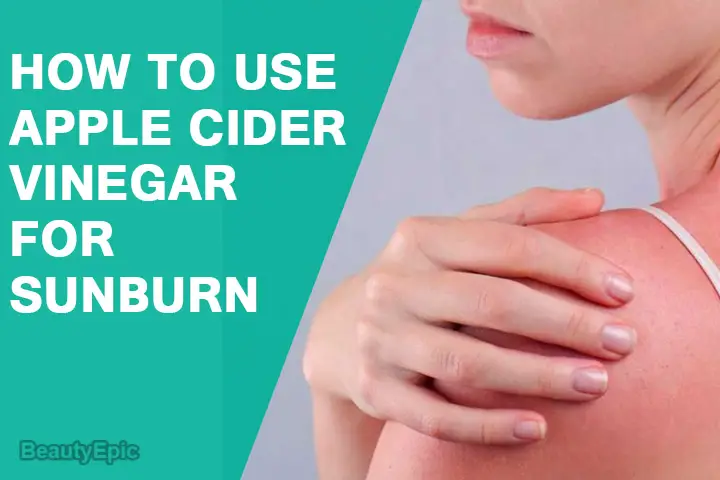 how to use apple cider vinegar for sunburn