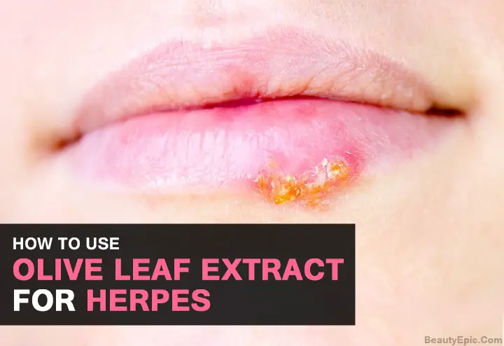 olive leaf extract for herpes