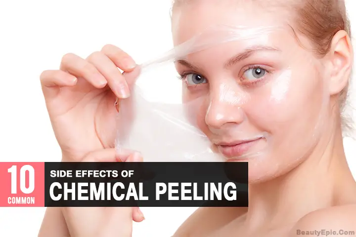 chemical peel side effects