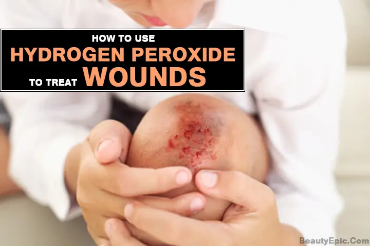 hydrogen peroxide for wounds