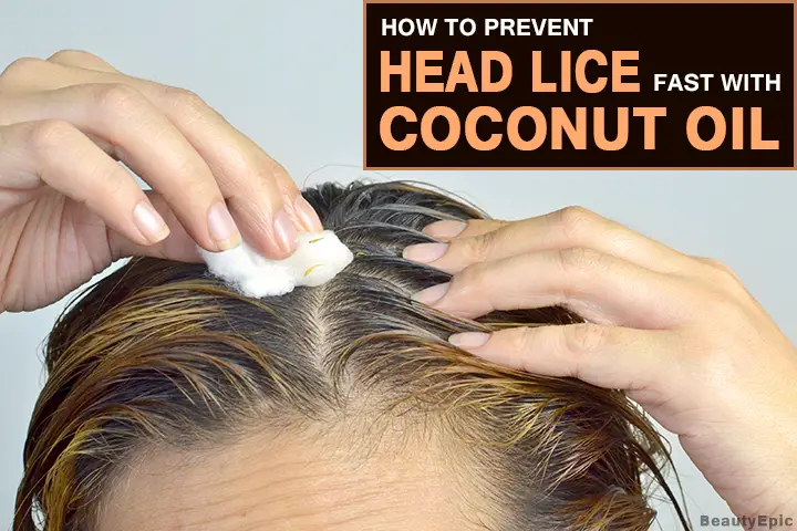 coconut oil for head lice
