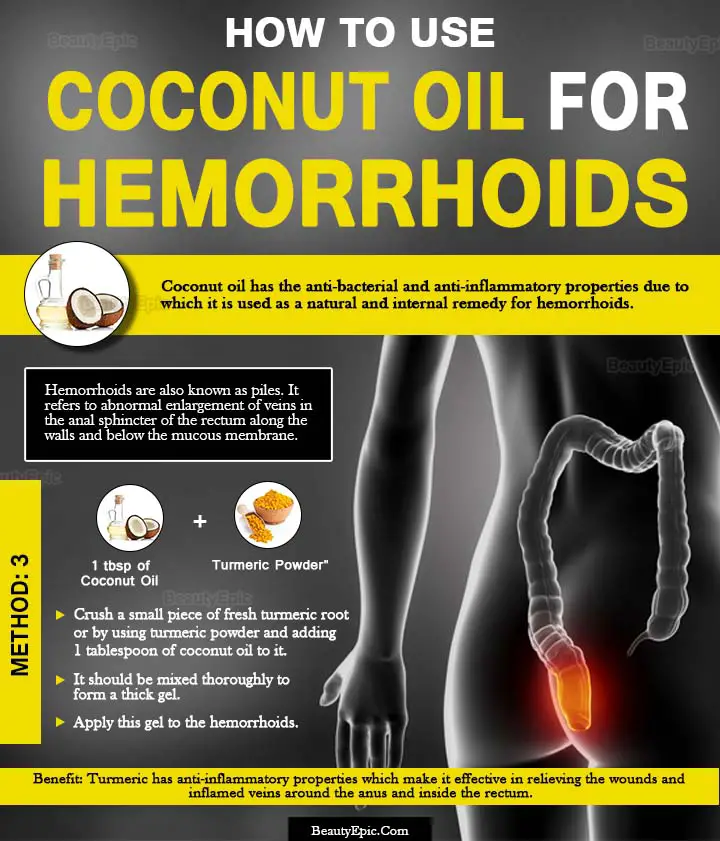 coconut oil for hemorrhoids