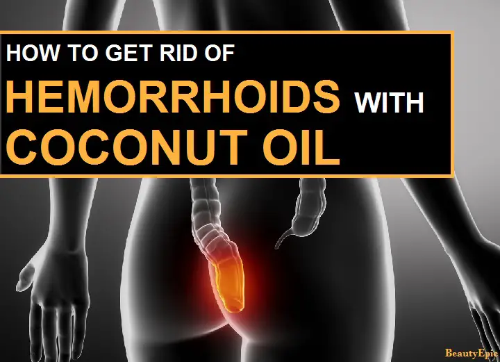 coconut oil for hemorrhoids