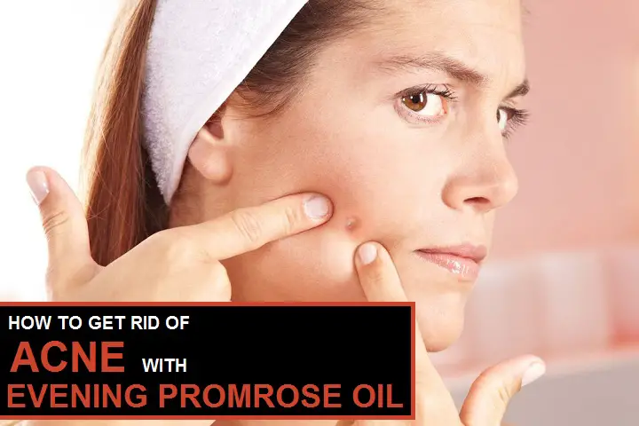 evening primrose oil for acne