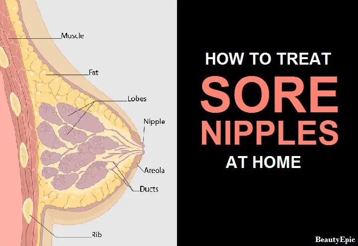 how to treat sore nipples