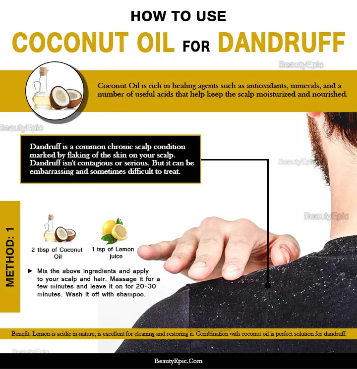 coconut oil for dandruff