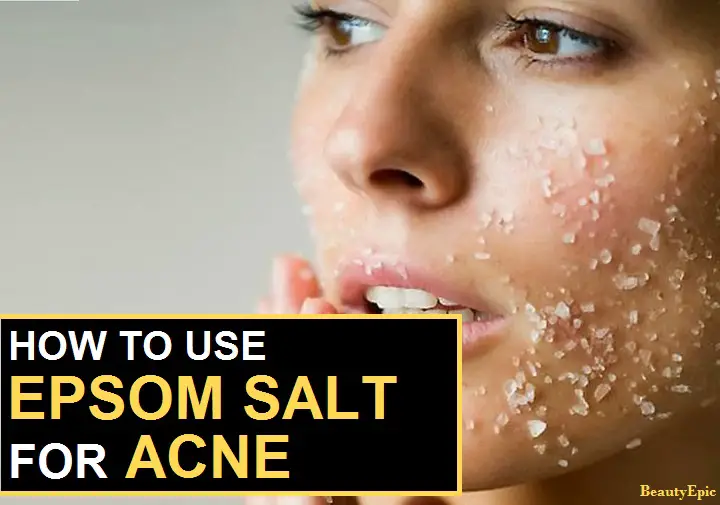 epsom salt for acne