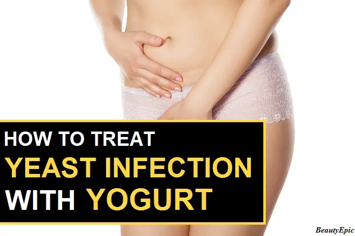 yogurt for yeast infection