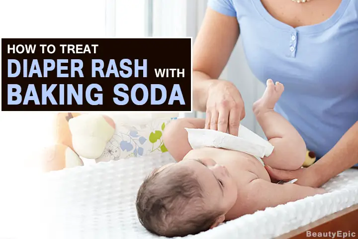 baking soda for diaper rash