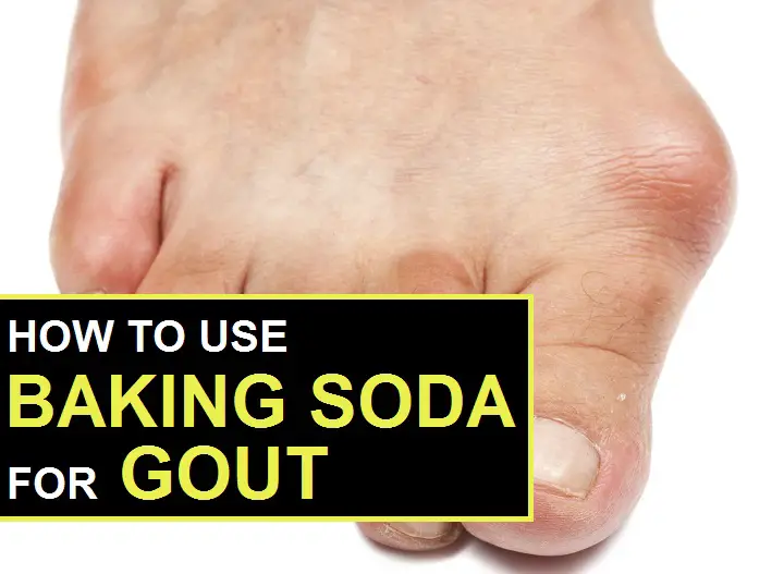 baking soda for gout