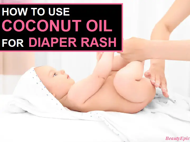 coconut oil for diaper rash