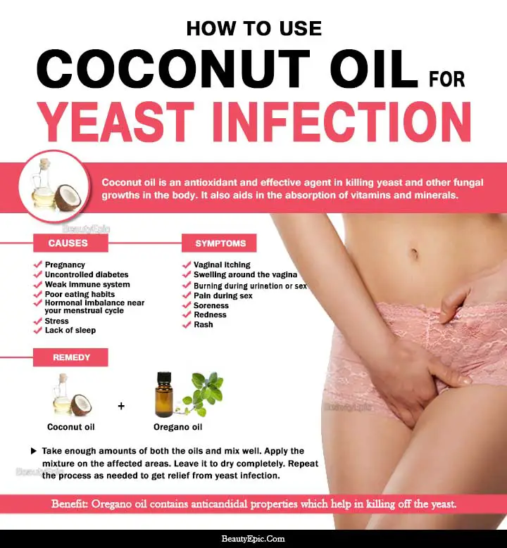 coconut oil for yeast infection